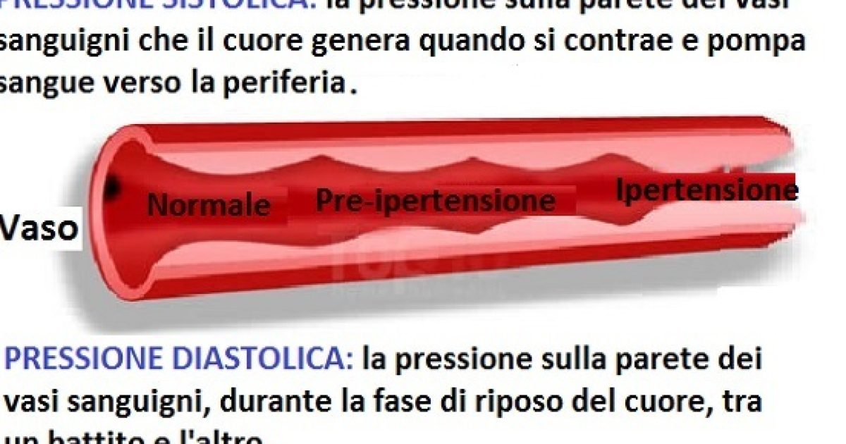 Secondo Le Nuove Linee Guida Statunitense Lipertensione Inizia Gi A