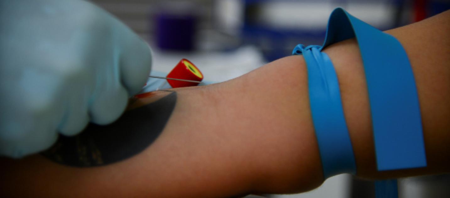 US making progress in fighting HIV despite challenges