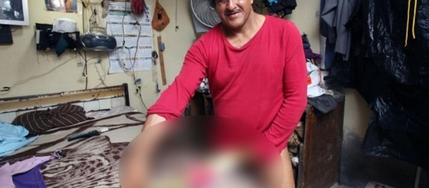 Homme Qui A Le Plus Gros Zizi Du Monde Le Plus Gros Pénis Au Monde - Esam Solidarity