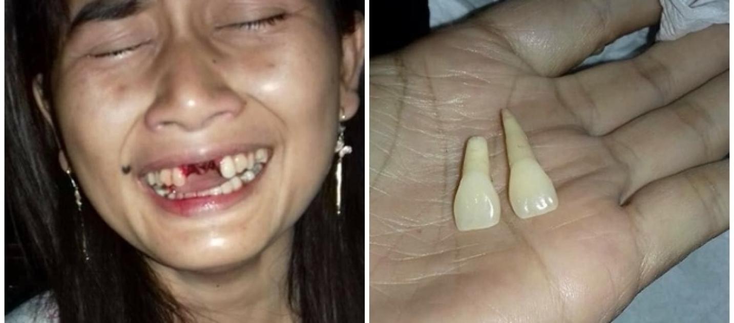 Resultado de imagem para Homem é preso por arrancar dois dentes da esposa viciada em celular com um chute