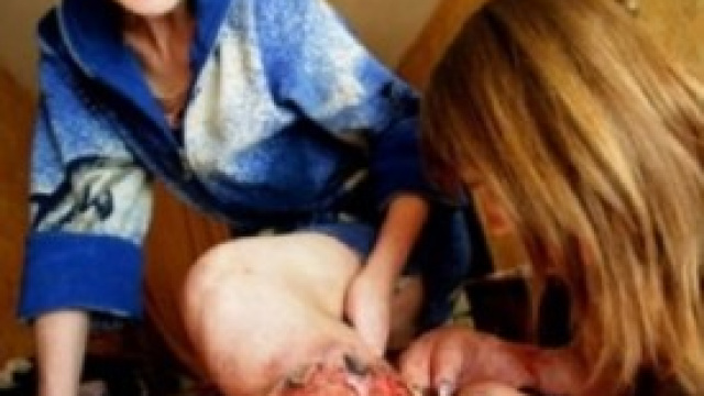 Gli effetti della droga Krokodil