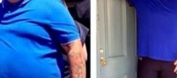 Graham Elliot prima e dopo l'operazione su Twitter Graham Elliot prima e dopo l'operazione su Twitter