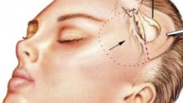 La pratica del lifting: donne e maschi