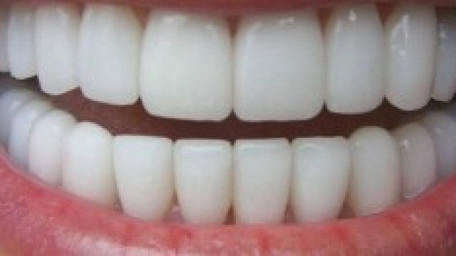 Carie: significato psicologico