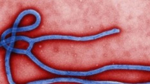 Che cos'&egrave; l'Ebola? Sintomi, contagio, trasmissione