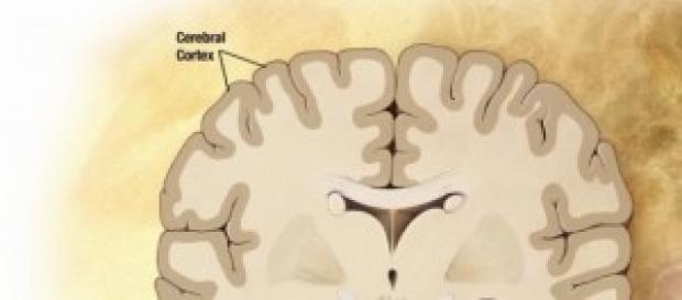 Alzheimer, nuevos progresos en su tratamiento. Alzheimer, nuevos progresos en su tratamiento.