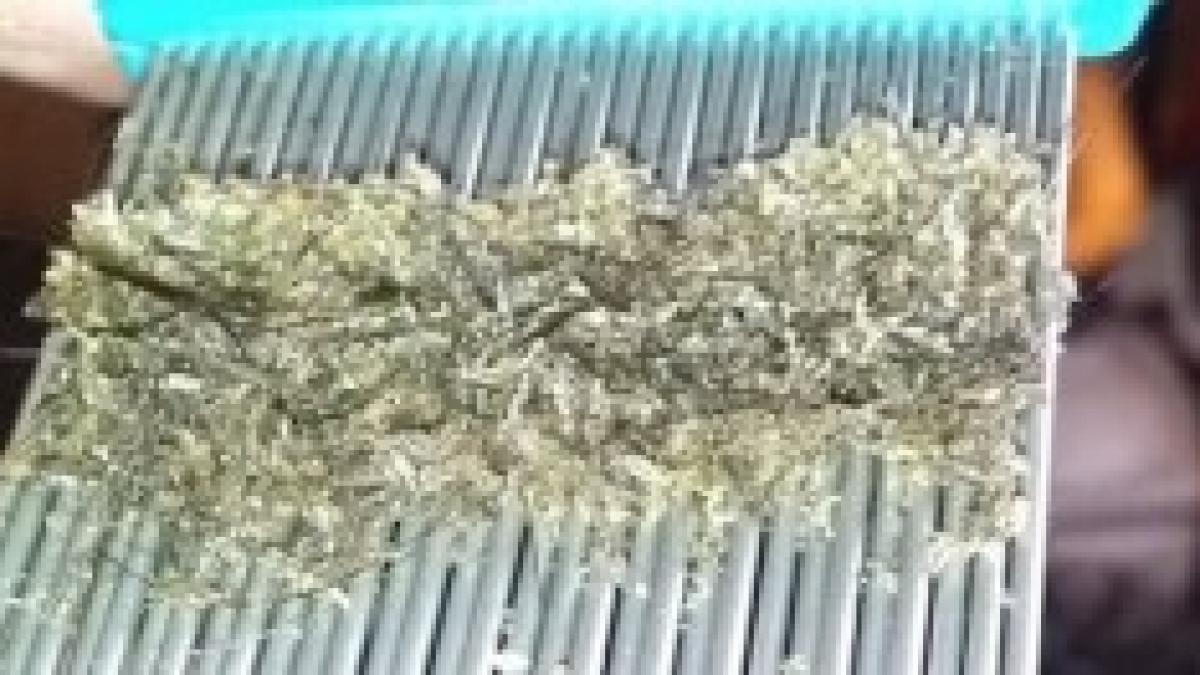 Madre Pettina Migliaia Di Pidocchi Dai Capelli Della Figlia