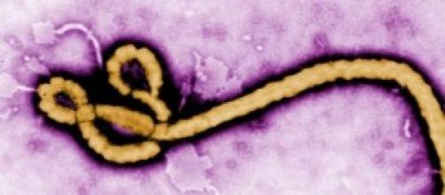 Ébola como prevenir el contagio