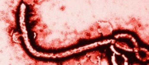 Virus Ebola al microscopio elettronico