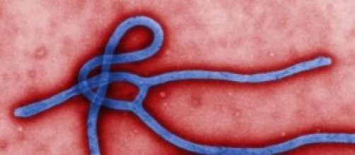 Virus Ebola: falsi allarme in Italia