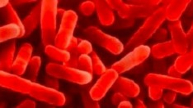 Legionella. Sei casi a Bresso, Milano.