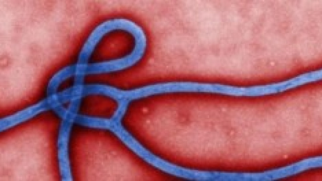 Virus Ebola: falsi allarme in Italia