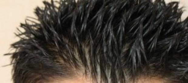 Causas y soluciones para el pelo graso. Causas y soluciones para el pelo graso.