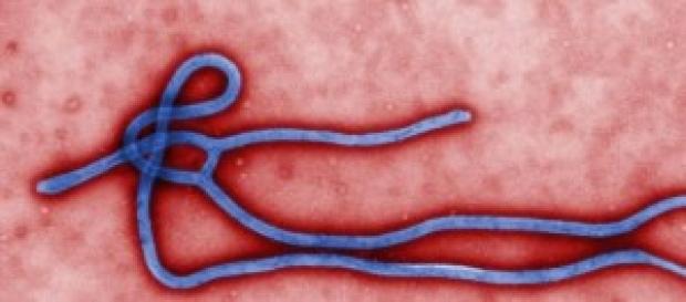 il Virus ebola ingrandito al microscopio il Virus ebola ingrandito al microscopio