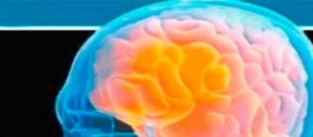 Imagen de una radiografía cerebral. Imagen de una radiografía cerebral.