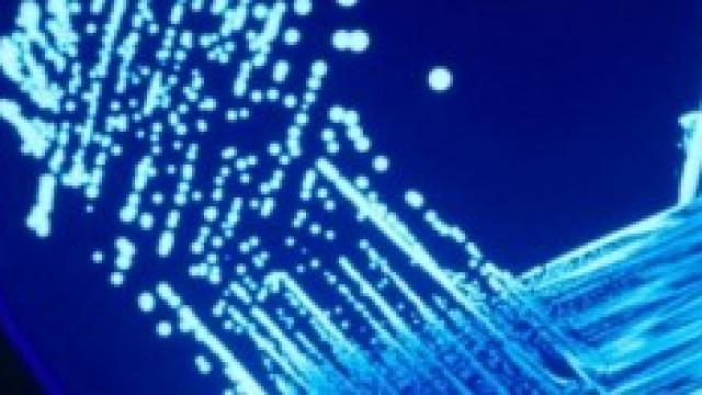 La legionella passa dalle condutture di casa