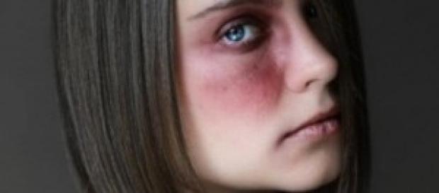 Violência doméstica em mulheres Violência doméstica em mulheres