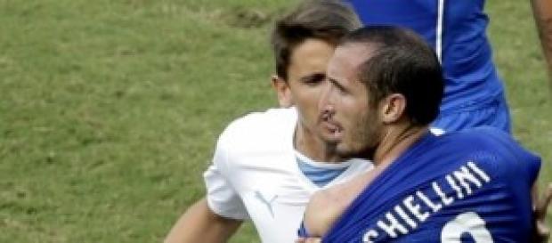 Chiellini mostra il morso di Suarez Chiellini mostra il morso di Suarez