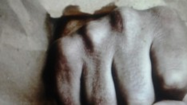 65enne in fin di vita dopo forti pugni al petto