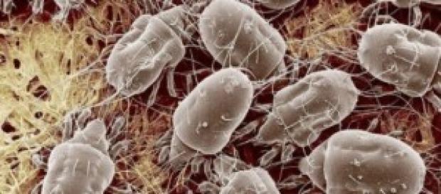 Oggetti comuni infestati da batteri Oggetti comuni infestati da batteri