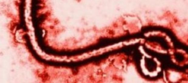 Medico italiano contagiato dal virus Ebola Medico italiano contagiato dal virus Ebola