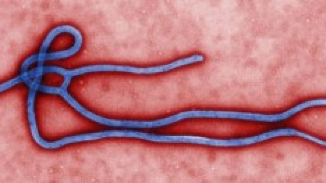 Foto del virione del virus Ebola.