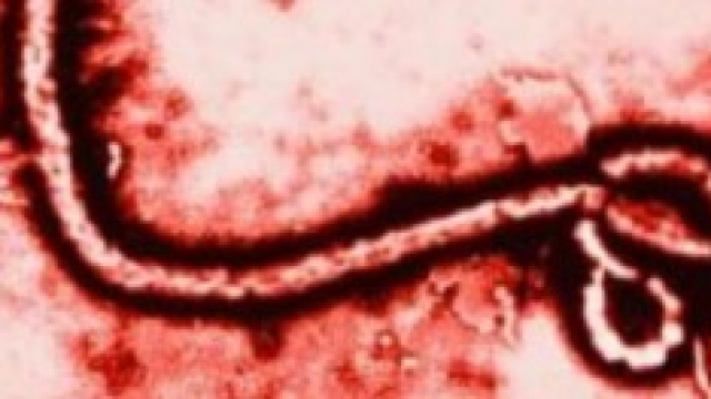 Medico italiano contagiato dal virus Ebola