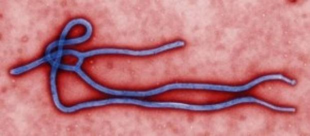Medico Emergency positivo a virus ebola Medico Emergency positivo a virus ebola