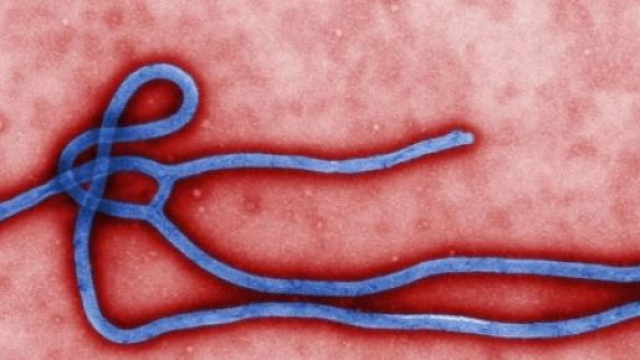 Il virus ebola in un'immagine da microscopio