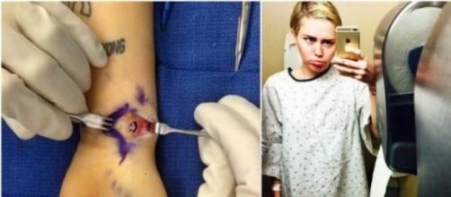 Miley Cyrus operada de un tumor en la muñeca.