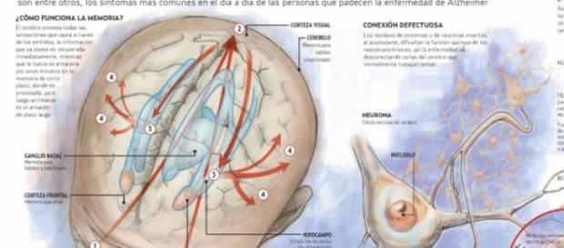 Nuevo tratamiento para curar el Alzheimer Nuevo tratamiento para curar el Alzheimer