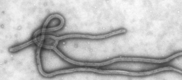 Vírus Ébola, ponto de situação Vírus Ébola, ponto de situação