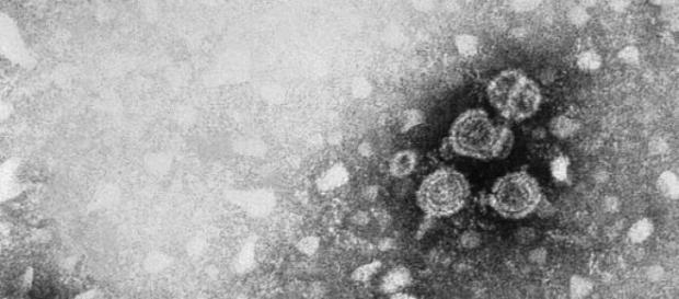 Viriones, hepatitis B, microfotografía electrónica Viriones, hepatitis B, microfotografía electrónica