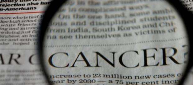 Cancro amigo, não te quero Cancro amigo, não te quero