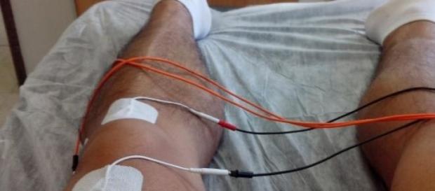 El Tens, sencillo y efectivo. El Tens, sencillo y efectivo.