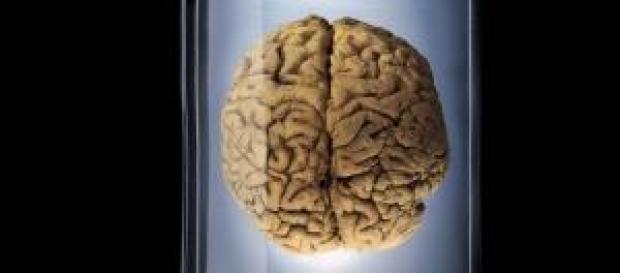 Desaparecen 100 cerebros de un s´tano Desaparecen 100 cerebros de un s´tano