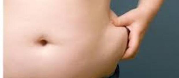 La obesidad, eje central del síndrome metabólico La obesidad, eje central del síndrome metabólico