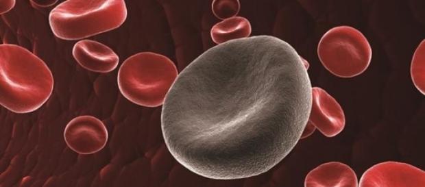 La leucemia: el "cáncer de la sangre" La leucemia: el "cáncer de la sangre"