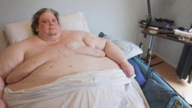 Keith Martin, l'uomo pi&ugrave; grasso del mondo