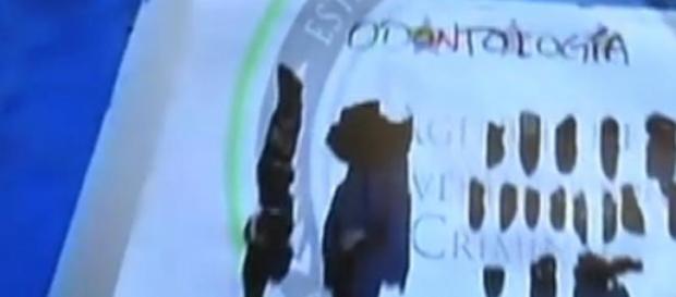 Imagen de restos óseos analizados Imagen de restos óseos analizados