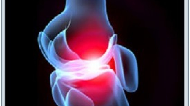 rimedi naturali artrite reumatoide