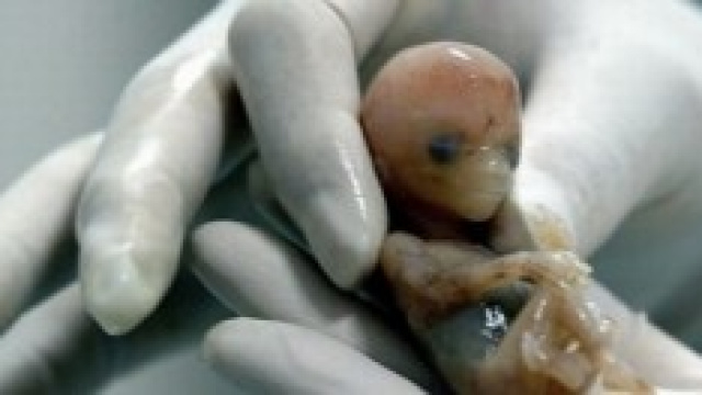 embrione alle prime settimane