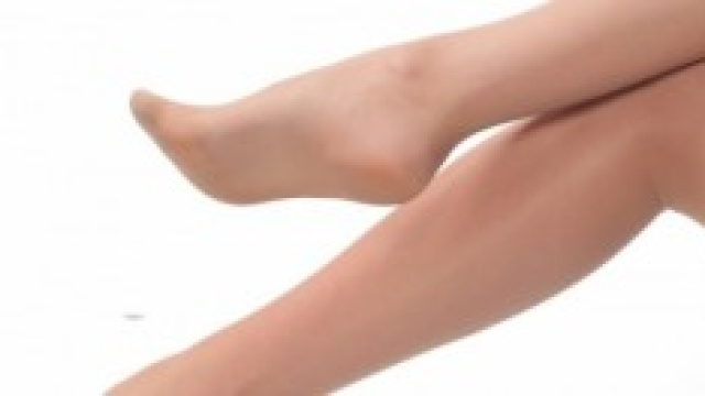 capillari fragili, vene varicose, circolazione