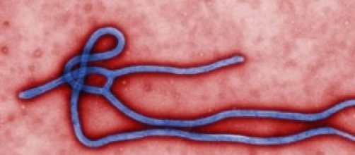 Virus Ebola 2014: sintomi e i rischi per l'Italia