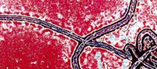 Virus Ebola: rischi anche per l'Italia?