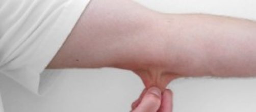 Prevenire tumori alla pelle: 5 regole del medico