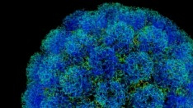 Poliomielite, allarme OMS in Siria