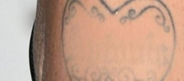 Huellas del tatuaje que Melanie se ha eliminado. Huellas del tatuaje que Melanie se ha eliminado.