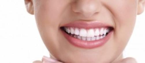¿Por qué deberíamos usar carillas dentales?