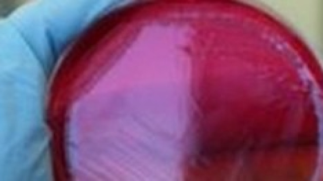Virus Ebola: allarme in tutto il mondo
